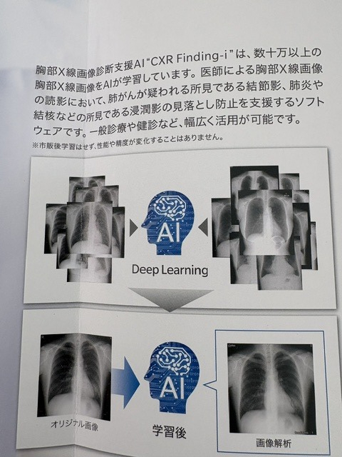 胸部AI friejoin